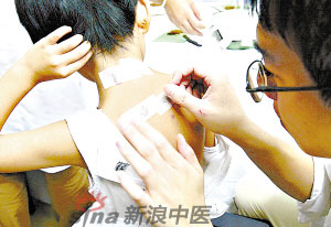 灸法的種類  你知道多少？