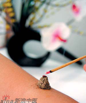 節(jié)氣灸” 冬至，你灸了嗎？